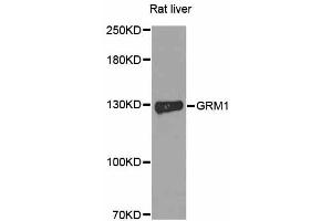 Western blot analysis of extracts of rat liver, using GRM1 antibody. (Metabotropic Glutamate Receptor 1 抗体)