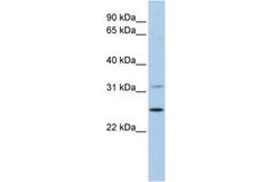 Image no. 1 for anti-Dehydrogenase/reductase (SDR Family) Member 1 (DHRS1) (AA 36-85) antibody (ABIN6743656) (DHRS1 抗体  (AA 36-85))