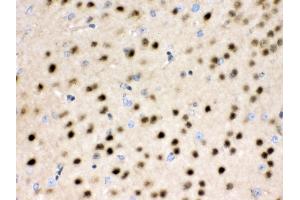 Anti- HDAC11 Picoband antibody,IHC(P) IHC(P): Rat Brain Tissue (HDAC11 抗体  (N-Term))