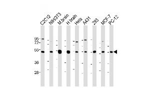 All lanes : Anti-beta II Tubulin Antibody at 1:2000 dilution Lane 1: C2C12 whole cell lysate Lane 2: NIH/3T3 whole cell lysate Lane 3: Mouse brain lysate Lane 4: Human brain lysate Lane 5: Hela whole cell lysate Lane 6: A431 whole cell lysate Lane 7: 293 whole cell lysate Lane 8: MCF-7 whole cell lysate Lane 9: PC-12 whole cell lysate Lysates/proteins at 20 μg per lane. (TUBB2A 抗体  (AA 194-225))