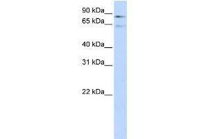 Western Blotting (WB) image for anti-Coagulation Factor 13, B Polypeptide (F13B) antibody (ABIN2458621) (F13B 抗体)
