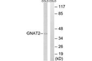 Western blot analysis of extracts from COLO cells, using GNAT2 Antibody. (GNAT2 抗体  (AA 1-50))