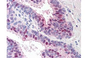 Anti-TARBP1 antibody IHC of human prostate. (TARBP1 抗体  (Internal Region))