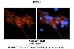 Researcher: Dr. (EIF3H 抗体  (N-Term))