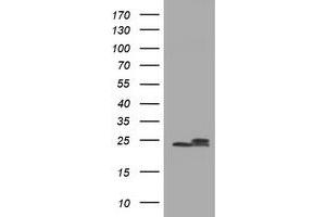 Image no. 9 for anti-NADH Dehydrogenase (Ubiquinone) 1 beta Subcomplex, 10, 22kDa (NDUFB10) antibody (ABIN1499672) (NDUFB10 抗体)