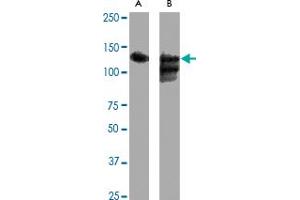 Western blot analysis of SIRT1 polyclonal antibody  expression in Hela (A) and Hela + CoC 12  (B) whole cell lysates. (SIRT1 抗体  (C-Term))