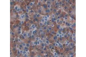 IHC-P analysis of Human Tissue, with DAB staining. (CXCL2 抗体  (AA 34-107))