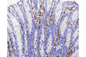 Immunohistochemistry (antigen was repair with 0.