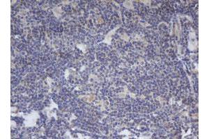 Image no. 1 for anti-B-Cell CLL/lymphoma 10 (BCL10) antibody (ABIN1496847) (BCL10 抗体)