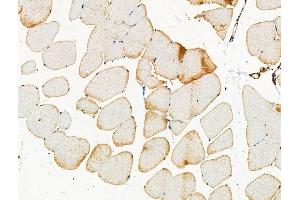 Phospho-PKD1/PKC mu (Ser205) Antibody at 1/100 staining Mouse muscle tissue by IHC-P. (PKC mu 抗体  (pSer205))