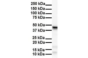WB Suggested Anti-SMYD5 antibody Titration: 1 ug/mL Sample Type: Human Hela (SMYD5 抗体  (C-Term))