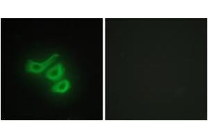 Immunofluorescence analysis of HepG2 cells, using M-CK Antibody. (CKM 抗体  (AA 10-59))