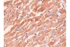 IHC-P analysis of Rat Heart Tissue, with DAB staining. (TNNI3 抗体  (AA 1-211))