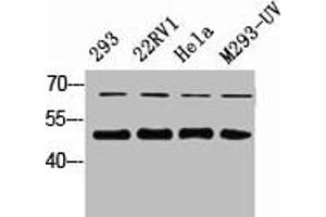 Western Blot analysis of 823 22RV1 HELA 293-UV cells using Smad2/3 Polyclonal Antibody (SMAD2 / SMAD3 抗体)