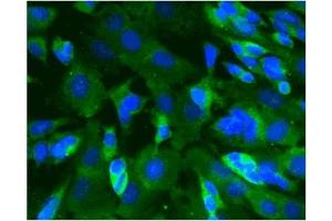 Immunofluorescence (IF) image for anti-Calcium/calmodulin-Dependent Protein Kinase II alpha (CAMK2A) (AA 448-460) antibody (ABIN968458) (CAMK2A 抗体  (AA 448-460))