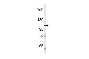 Western blot analysis of Denatured ATG1 (ABIN653062 and ABIN2842663) in mouse cerebellum tissue lysates (35 μg/lane). (Denatured ATG1 抗体)