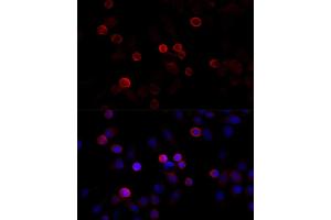 Immunofluorescence analysis of HeLa cells using FLNC antibody (ABIN6127928, ABIN6140681, ABIN6140682 and ABIN6216847) at dilution of 1:100 (40x lens). (FLNC 抗体  (AA 2160-2340))