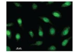 Immunostaining analysis in HeLa cells. (ARNTL2 抗体)
