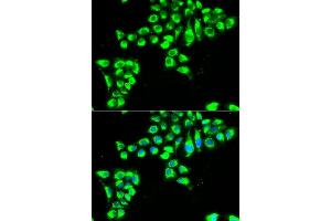 Immunofluorescence analysis of HeLa cells using CLDN2 antibody (ABIN6127703, ABIN6138684, ABIN6138687 and ABIN6222231). (Claudin 2 抗体  (AA 30-230))