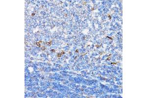 Immunohistochemistry of paraffin-embedded rat spleen using NDE1 antibody. (NDE1 抗体  (AA 1-110))