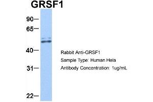 Host:  Rabbit  Target Name:  GRSF1  Sample Type:  Hela  Antibody Dilution:  1. (GRSF1 抗体  (Middle Region))