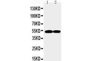 Anti-FLI1 antibody, Western blotting Lane 1: JURKAT Cell Lysate Lane 2: RAJI Cell Lysate (FLI1 抗体  (N-Term))