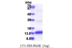SDS-PAGE (SDS) image for Colipase, Pancreatic (CLPS) (AA 18-112) protein (His tag) (ABIN5853695) (CLPS Protein (AA 18-112) (His tag))