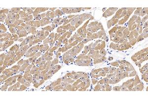 Detection of ACTC1 in Human Cardiac Muscle Tissue using Monoclonal Antibody to Actin Alpha 1, Cardiac Muscle (ACTC1) (ACTC1 抗体  (AA 156-368))