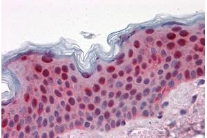 Human Skin: Formalin-Fixed, Paraffin-Embedded (FFPE) (14-3-3 sigma/SFN 抗体  (AA 1-249))