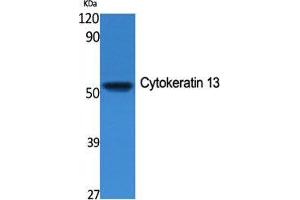 Western Blot (WB) analysis of specific cells using Cytokeratin 13 Polyclonal Antibody. (Cytokeratin 13 抗体  (Internal Region))