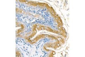 Immunohistochemistry of paraffin embedded rat stomach using CK13 (ABIN7074411) at dilution of 1:1200 (400x lens) (Cytokeratin 13 抗体  (C-Term))