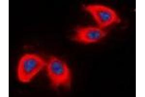 Immunofluorescent analysis of DCLK2 staining in HepG2 cells. (DCLK2 抗体  (N-Term))