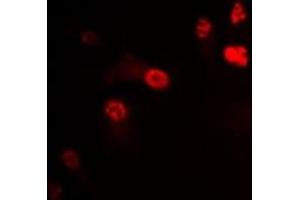 Immunofluorescent analysis of P2X4 staining in U2OS cells. (P2RX4 抗体)