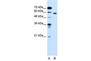 Image no. 2 for anti-Oxysterol Binding Protein-Like 9 (OSBPL9) (AA 73-122) antibody (ABIN6736683) (OSBPL9 抗体  (AA 73-122))