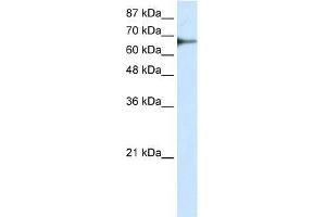 Transfected 293T; WB Suggested Anti-L3MBTL2 Antibody Titration: 0. (L3MBTL2 抗体  (C-Term))