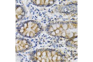 Immunohistochemistry of paraffin-embedded human colon using PTPRA Antibody (ABIN3015783, ABIN3015784, ABIN1682399 and ABIN6219134) at dilution of 1:100 (40x lens). (PTPRA 抗体  (AA 20-142))