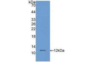Detection of Recombinant S100A11, Rat using Polyclonal Antibody to S100 Calcium Binding Protein A11 (S100A11) (S100A11 抗体  (AA 9-98))