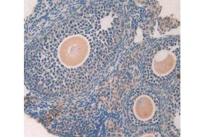 IHC-P analysis of ovary tissue, with DAB staining. (GDF5 抗体  (AA 358-495))