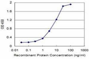 Detection limit for recombinant GST tagged KLF5 is approximately 0. (KLF5 抗体  (AA 358-457))