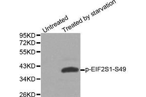 Western blot analysis of extracts from Hela cells, using phospho-EIF2S1-S49 antibody. (EIF2S1 抗体  (pSer49))