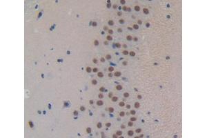Used in DAB staining on fromalin fixed paraffin- embedded Kidney tissue (FOXP1 抗体  (AA 122-346))