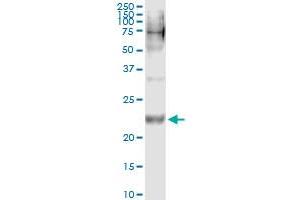 Immunoprecipitation of WISP2 transfected lysate using anti-WISP2 monoclonal antibody and Protein A Magnetic Bead , and immunoblotted with WISP2 MaxPab rabbit polyclonal antibody. (WISP2 抗体  (AA 24-250))