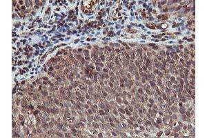 Image no. 9 for anti-V-Akt Murine Thymoma Viral Oncogene Homolog 1 (AKT1) antibody (ABIN1496557) (AKT1 抗体)