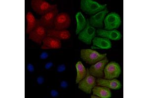 ABIN7094233 and ABIN7098280 staining Hela cells by IF/ICC.