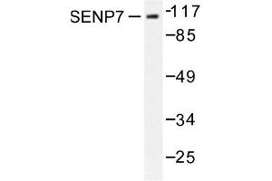 Image no. 1 for anti-SUMO1/sentrin Specific Protease 7 (SENP7) antibody (ABIN271960) (SENP7 抗体)