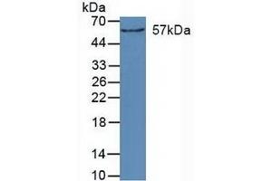Detection of CYP27B1 in Mouse Kidney Tissue using Polyclonal Antibody to Cytochrome P450 27B1 (CYP27B1) (CYP27B1 抗体  (AA 256-508))