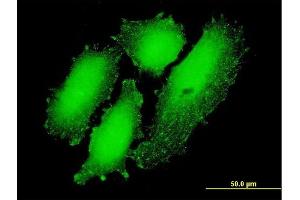 Immunofluorescence (IF) image for anti-CAMP Responsive Element Binding Protein 3-Like 4 (CREB3L4) (AA 1-110) antibody (ABIN566851)