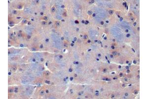 DAB staining on IHC-P; Samples: Mouse Cerebrum Tissue (CDK18 抗体  (AA 121-402))