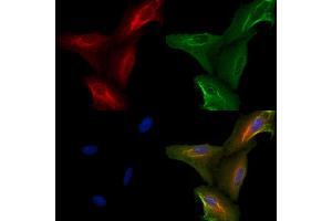 ABIN6264768 and ABIN6272617 staining  cells by IF/ICC. (RIPK3 抗体  (Internal Region))