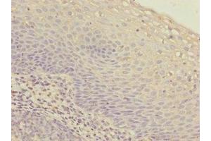 Immunohistochemistry of paraffin-embedded human tonsil tissue using ABIN7156265 at dilution of 1:100 (IKbIP 抗体  (AA 121-350))